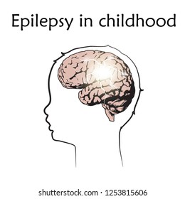 Epilepsy In Infants, Childhood. Vector Medical Illustration. Kid, Baby, Childhood. White Background, Line Silhouette Of Child Head, Anatomy Flat Image Of Brain, Electrical Discharge.