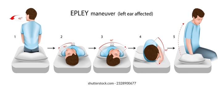 Epley maneuver illustration, a practical guide for the treatment of positional paroxysmal vertigo. With damage to the left ear. Vector.