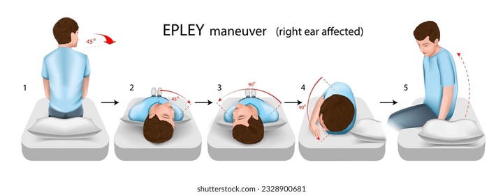 Epley maneuver illustration, a practical guide for the treatment of positional paroxysmal vertigo. With damage to the right ear. Vector.