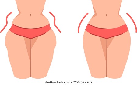 EPS10 vector illustration of hip dips before and after