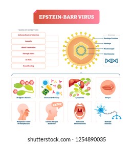 Epstein barr virus vector illustration. Labeled herpes disease explanation. Structural scheme with syndromes diagram. Infection obtaining ways examples set. Mouth and oral medical abnormal disorders.