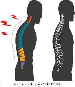 Ergonomic Infographic Standing posture of black human spine infographic Template Design. Concept of Bad postures office syndrome. Office syndrome vector flat icons cartoon design eps10 illustration