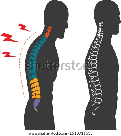 Ergonomic Infographic Standing posture of black human spine infographic Template Design. Concept of Bad postures office syndrome. Office syndrome vector flat icons cartoon design eps10 illustration