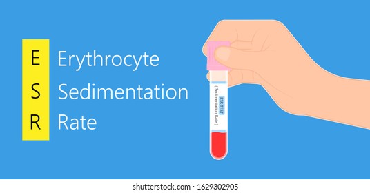 149 Erythrocyte sedimentation rate Images, Stock Photos & Vectors ...