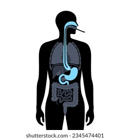 Esophageal achalasia medical poster. Failure of smooth muscle fibers to relax. Gastrointestinal tract disease. Closed lower esophageal sphincter, digestive system disorder flat vector illustration.