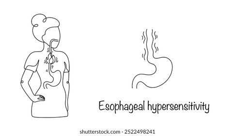 Hipersensibilidad esofágica. Trastorno funcional caracterizado por dolor en la zona torácica asociado con la ingestión de alimentos o líquidos. Una mujer experimenta una sensación de ardor en el esófago. Vector.