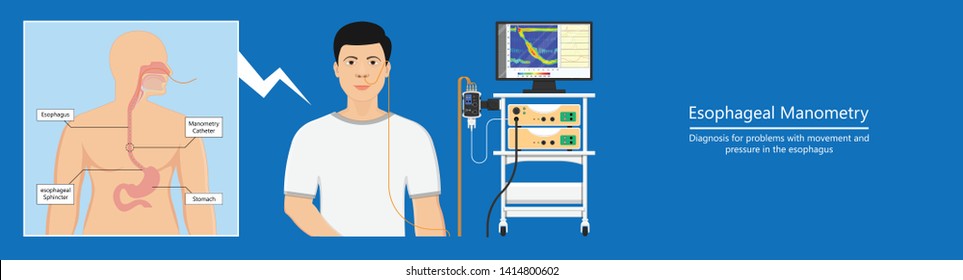 Esophageal Manometry Test Esophageal Diagnose Food High Resolution Impedance HRM Difficulty Swallowing Achalasia Treat Acid