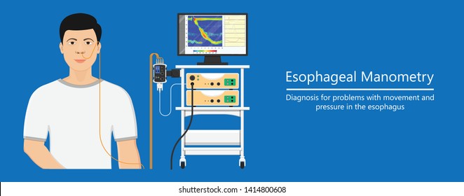 Esophageal Manometry Test Esophageal Diagnose Food High Resolution Impedance HRM Difficulty Swallowing Achalasia Treat Acid