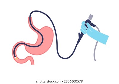 Esophagogastroduodenoscopy medical poster. Diagnostic endoscopic minimally invasive procedure. Visualization of the esophagus, stomach, and proximal duodenum. Gastroenterology flat vector illustration