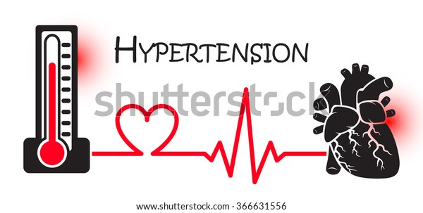 ¿La presión arterial muestra un ataque al corazón?
