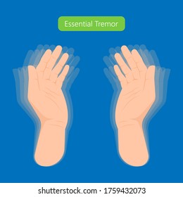 Essential tremor Deep brain stimulation DBS surgery device implant nerve uncontrollable arms head voice disability abnormal electrical controls muscle activity elderly Balance problem parkinson's