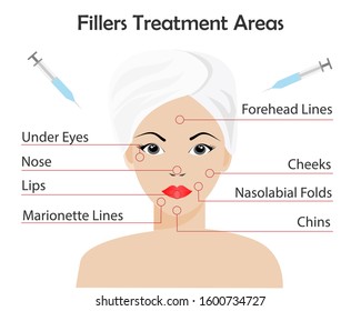 Esthetic medicine, dermal Fillers Injection Treatment areas. Beautiful woman's face with red points show injection area. Idea for beauty plastic surgery, cosmetology, professional anti aging concept.