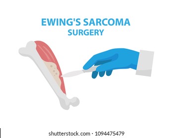 Ewing's Sarcoma Surgery Vector Illustration Isolated On White Background In Flat Design. Medical Infographic Elements With Surgeon's Hand Keeping Scalpel And Doing Surgery And Removing Cancer Tumor.