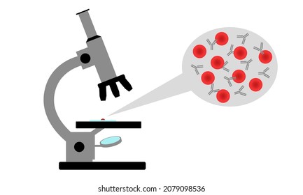 Examen de la sangre bajo un microscopio para detectar la presencia de anticuerpos.