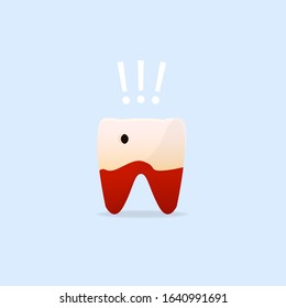 An example of a diseased tooth with a hole signaling danger. Tooth on a blue background.