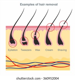 Examples of hair removal: waxing, shaving, tweezers, creams, wax