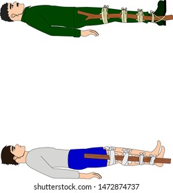 Examples of improvised leg splint