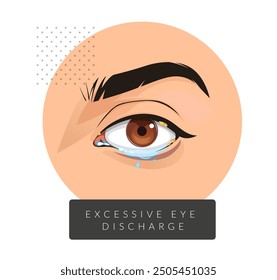 Excessive Sticky Discharge from Human Eye - Stock Illustration as EPS 10 File