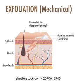 Exfoliation. Peeling or Physically scrubbing.  Exfoliation is removal of the old dead cells on the skin's outer surface. Cross-section skin layers