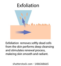 Exfoliation or Peeling, vector illustration isolated on the white background with arrows