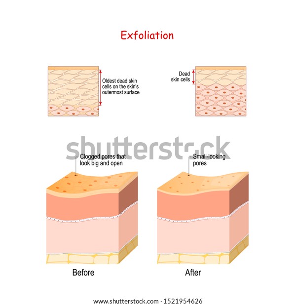 Exfoliation is removal of the old\
dead skin cells on the skin\'s outer surface. Cross-section of skin\
layers before and after Exfoliation. Close-up of epidermal\
cells.