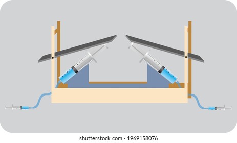 Experiment consisting of pieces of serum sodium with a syringe