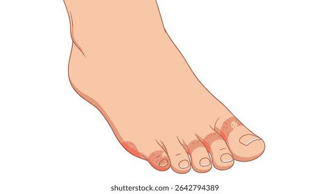 Exploring the Intricacies of the Human Foot An Anatomical Marvel of Engineering