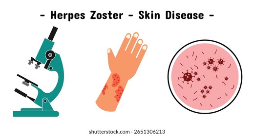 Exposure design of herpes zoster skin disease on the hand and illustration of microscope and virus.