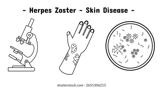 Exposure design of herpes zoster skin disease on the hand and illustration of microscope and virus. In outline style.