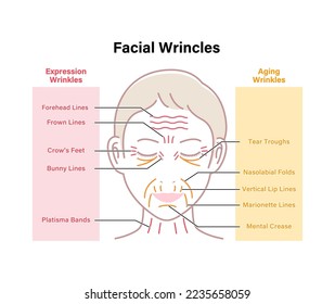 Expression wrinkles and Aging wrinkles ( female face ) vector illustration 