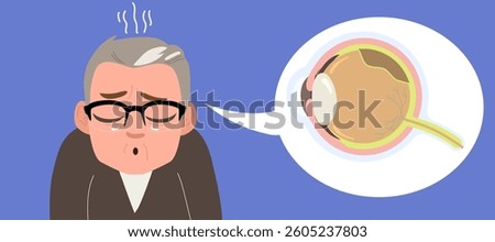 Expressive cartoon illustration of an elderly man experiencing retina detachment symptoms. Drawing of cross section eye showing vision problem on retina. Awareness campaigns about vision problems, agi