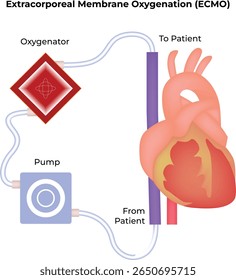 Diagrama del sistema ECMO de oxigenación por membrana extracorpórea