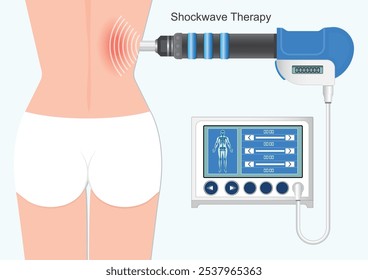 Terapia de ondas de choque extracorpóreas para los músculos de la espalda. Promueve el alivio del dolor, la recuperación muscular y la salud de la columna vertebral. (ESWT para abreviar) Atención médica, Ilustración vectorial.