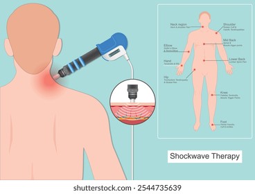 Extracorporeal Shock Wave Therapy (ESWT for short) proved to be efficient and safe in the treatment of shoulder pathologies, improving pain, range of motion, medical health care vector illustration.