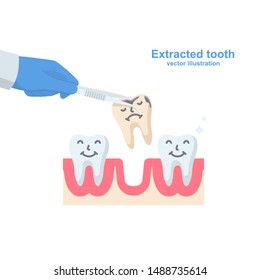 Extracted tooth in tongs. Dentist pulls out sick tooth. Stamatologic concept. Remove root. Vector illustration flat design. Isolated on background. Tweezers in hands.