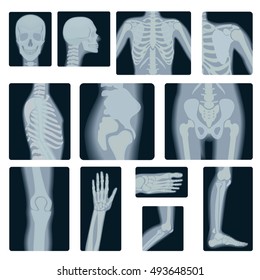 Extreme quality realistic vector collage set of many X-rays shots. X-ray multiple part of adult people