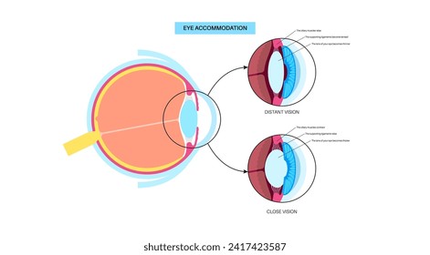 Eye accommodation infographic. Retina and sclera, ciliary muscle are contracted and relaxed, rounded and flattened lens. Objects at different distances and maintain clear images vector illustration