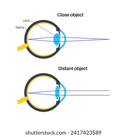 Eye accommodation infographic. Retina and sclera, ciliary muscle are contracted and relaxed, rounded and flattened lens. Objects at different distances and maintain clear images vector illustration