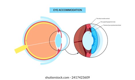 Eye accommodation infographic. Retina and sclera, ciliary muscle are contracted and relaxed, rounded and flattened lens. Objects at different distances and maintain clear images vector illustration