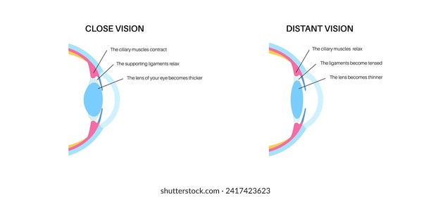 Eye accommodation infographic. Retina and sclera, ciliary muscle are contracted and relaxed, rounded and flattened lens. Objects at different distances and maintain clear images vector illustration