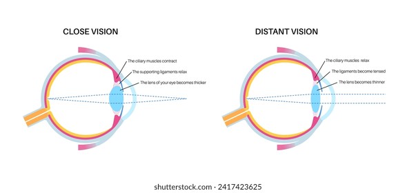 Eye accommodation infographic. Retina and sclera, ciliary muscle are contracted and relaxed, rounded and flattened lens. Objects at different distances and maintain clear images vector illustration