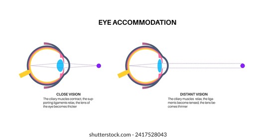 Infografía de alojamiento ocular. Retina y esclera, músculo ciliar se contraen y relajan, con lentes redondeadas y aplanadas. Objetos a diferentes distancias y mantener imágenes nítidas ilustraciones vectoriales