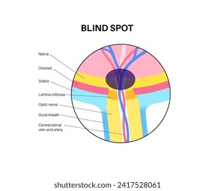 Eye anatomy and blind spot, optic disc anatomical poster. Scotoma infographic banner. Place in the retina where the optic nerve connects. One kind of optical illusion medical flat vector illustration