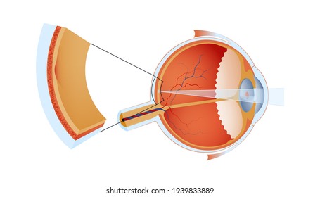 Eye Ball Structure. Modern Flat Vector Illustration. Detailed Anatomy of the Healthy Eye and Focal Point. Website Banner. Social Media Template. 