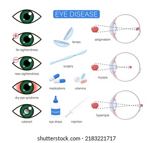 Eye Diseases Disorder Cartoon Illustration Set Stock Vector (Royalty ...