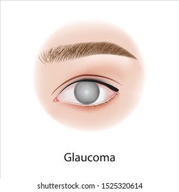 Eye diseases , problem vector illustration