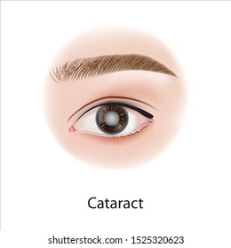 Eye diseases , problem vector illustration