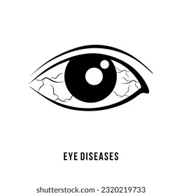 Eye diseases vector icon. Eye Infection and irritation symbol isolated on white background. Eye pain logo or sign. Vector