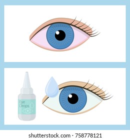 Eye drops on white background, cartoon illustration of medical accessory for correct vision. Vector