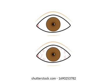Icono ocular de un rostro humano sobre fondo blanco, órgano del globo ocular enfermo y saludable, Anatomía educativa, Ilustración vectorial de ojos